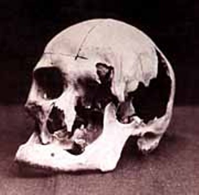 Andrew skull